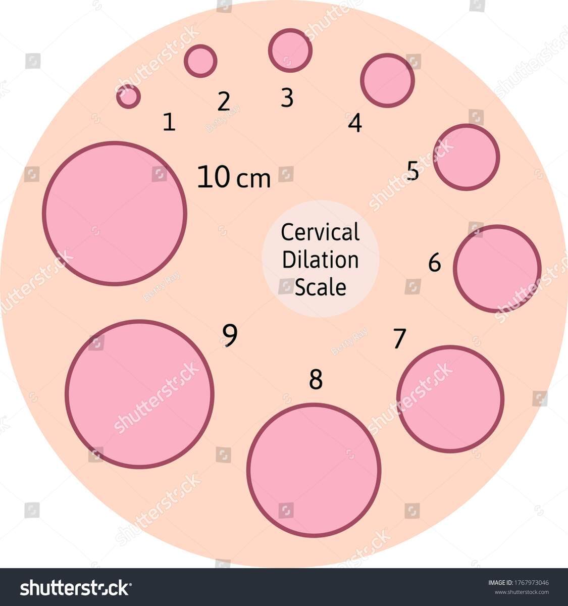 Cervial Dilation Scale Pink Circles Cervical Stock Vector Royalty Free 1767973046 Shutterstock