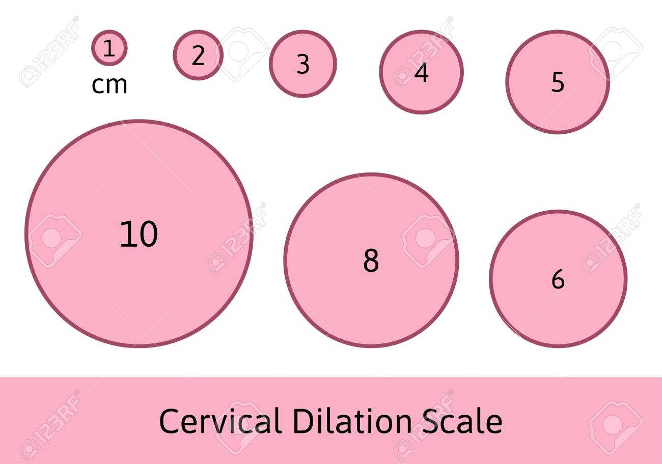 Cervial Dilation Scale With Pink Circles Shows How Cervix Is Opening During Delivery Process Medical Illustration Chart In Centimeters Isolated On White Background Royalty Free SVG Cliparts Vectors And Stock Illustration Image