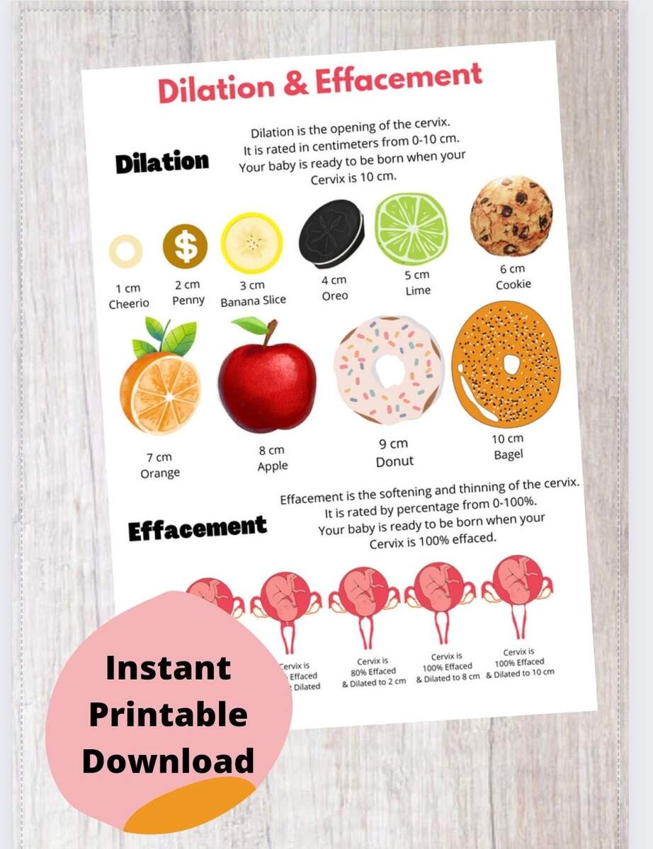Cervical Dilation Chart Handout Cervical Dilation Tool Cervical Dilation Wheel Childbirth Birth Class Education Birth Class Teaching Etsy