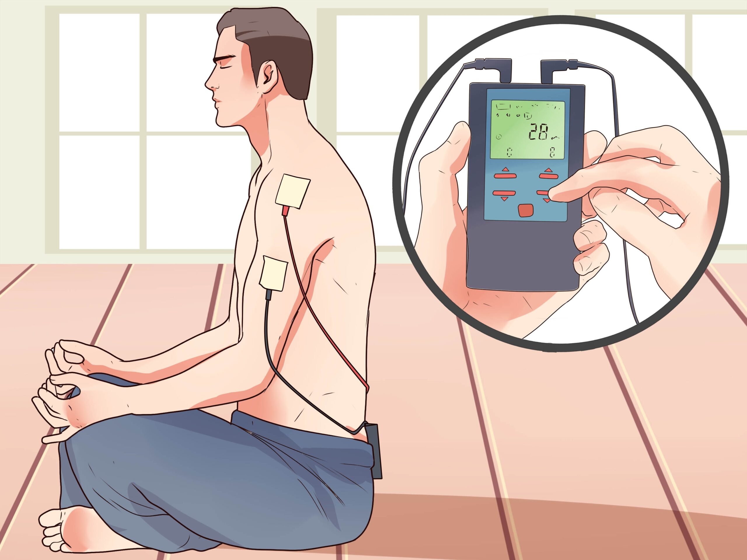 How To Place Electrodes For A Tens Unit 11 Steps With Pictures