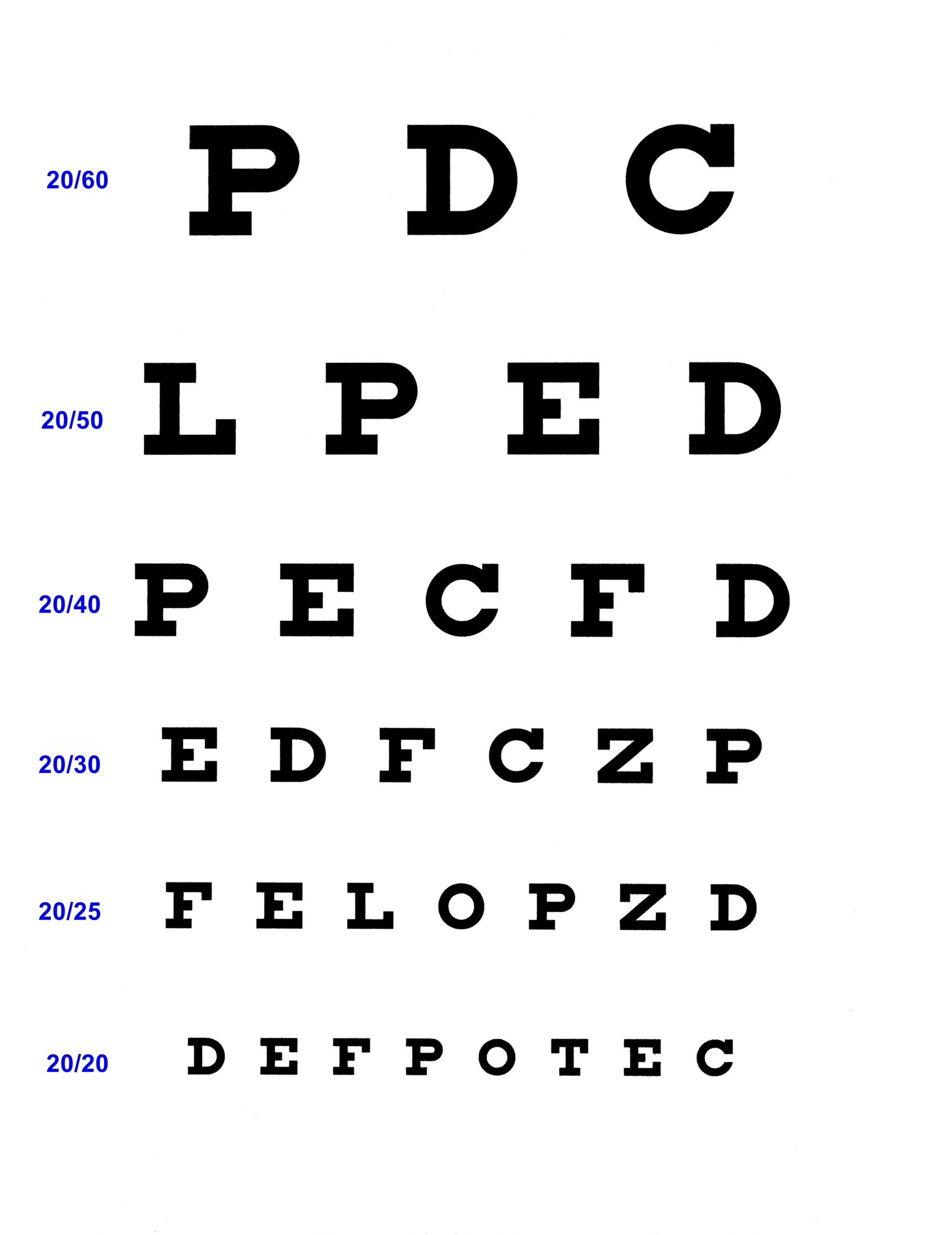 Opthalmoscope Otoscope Set Snellen Eye Chart Visual Acuity Chart 22x11 Inches For Eye E Tuning Fork Opthalmoscope Otoscope Set Snellen Eye Chart Visual Acuity Chart 22x11 Inches For Eye E Tuning Fork